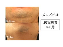 メンズビオ 神戸三宮店/