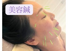 ひなた鍼灸