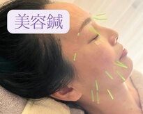 ひなた鍼灸