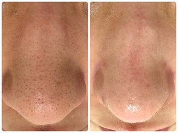 サイセイ(SAISEI)/