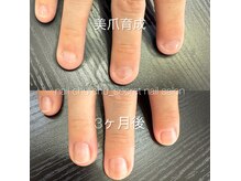 お爪の悩みを相談できるサロン#JESSICA美爪育成士在籍