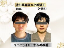 エモシオン トウキョウ(EMOTION TOKYO)/造形フェイス