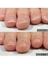 自爪育成ネイルケア