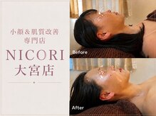ニコリ 大宮(NICORI)