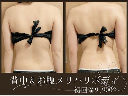 リズビー(Lisbe)の写真