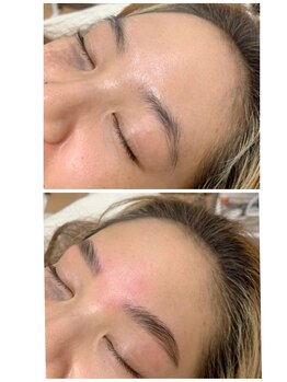 ラ フルール(La Fleur)/ハリウッドブロウリフト