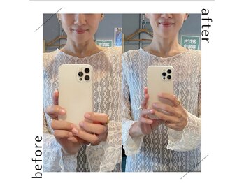 キワミ(KIWAMI)/#首専門整体＃首スッキリ