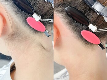 ネリネ 天神(nerine)/うなじワックス☆ブライダル脱毛