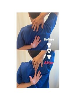 駒込整体院/肩甲骨・肩こり解消