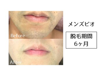 メンズビオ 神戸三宮店/