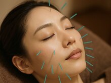 コハルはり灸整骨院(koharuはり灸整骨院)