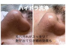 ベルエス(bell.s)/清潔感と自然な艶のある肌へ