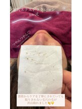 ジュエルオーキッド(Jewel orchids)/毛穴エクストラクションtete式