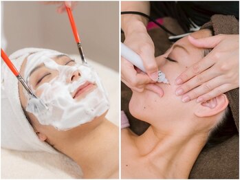 ピュアボディ(Pure Body)の写真/剥かないピーリングで水光肌【全顔♪ララピール＋シミケア体験】毛穴・ニキビ予防にも◎くすみも一掃！