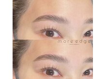 モアエッジ 五反田店(more edge)/"Hollywood brow lift"