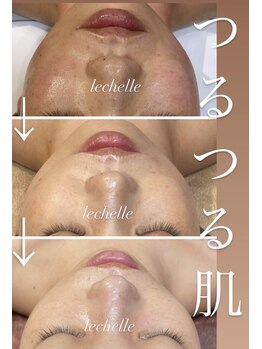 レシェルサロン(Lechelle Salon)/ダクトピーリング