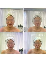 ベルフィーヌボーテ(BELFINE beaute)/ベルフィーヌ式小顔コルギ