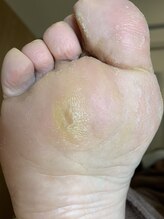 足楽 京都御池店/魚の目とタコ