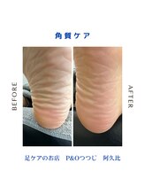ピーアンドオー(P&O)/