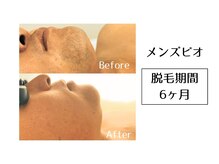 メンズビオ 神戸三宮店/