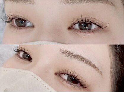 ブレス(Blss)の写真