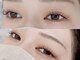 ブレス(Blss)の写真