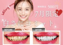 エクシアホワイト SOKA(ecxia white)