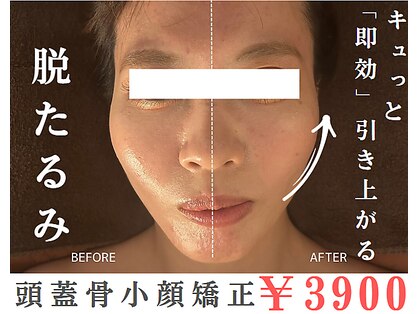 頭蓋骨 小顔矯正サロン グレースフィオーレ 札幌店(gracefiore)の写真