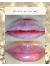 スノースキン(Snow skin)/ローマピンク/リップ　