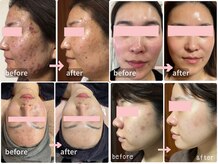 マヨズサロン(MAYO's salon)