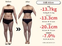 ニドム/32歳　-13kg痩身ダイエット1