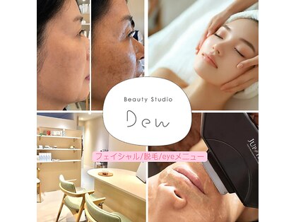 デュウ(DEW)の写真