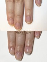 マリーロール 梅田店(Marie Laure)/自爪育成/深爪矯正/ネイルケア