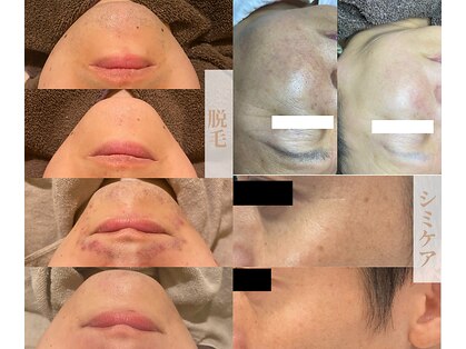 サロンステラ(SALON STELLA)の写真