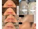 サロンステラ(SALON STELLA)の写真