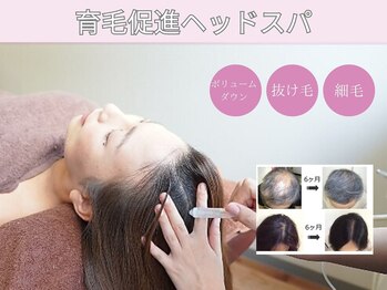 スーパースカルプ 長崎店(SuperScalp)