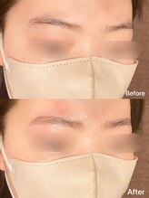 パピヨン(papillon)/ハリウッドブロウリフト【HBL】