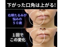 目元 口元のたるみ 眉間シワ改善専門サロン/輪郭の左右歪みが気になる方向け