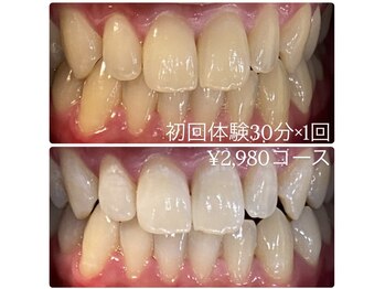 ホワイトニングルーム 横浜店(Whitening Room)/セルフホワイトニング/横浜