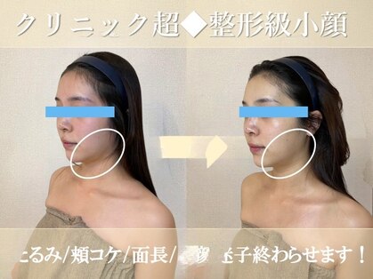 ココ(COCO)の写真