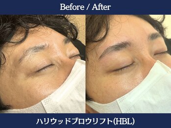 ランドマーク 中崎町(LANDMARK.)/《 ハリウッドブロウリフト 》