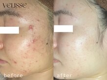 ヴェリス 福岡店(Velisse)/