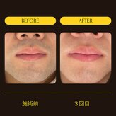 ラポール(Rapport)