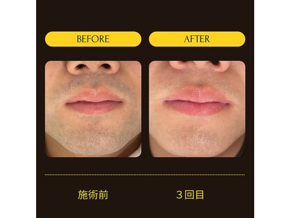 ラポール(Rapport)の写真