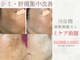 アトリア(ATRIA)の写真