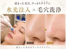i'm este 平塚店【肌管理×小顔/毛穴改善フェイシャルサロン】-小顔/毛穴/シミケア-の雰囲気（小顔/毛穴洗浄/毛穴/フェイシャル/シミケア/ニキビケア/平塚）