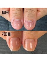 ピュアティネイル(purity nail)/最強ネイルケア