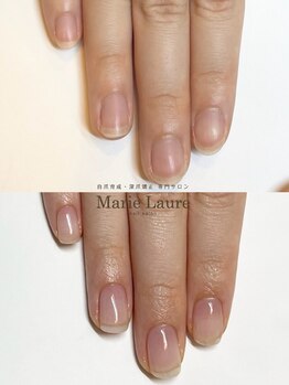 マリーロール 梅田店(Marie Laure)/自爪育成/深爪矯正/ネイルケア