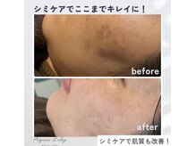 アクアリリー(Aqua Lily)の雰囲気（お肌に負担をかけないシミケアで、全体の透明感もアップ！）