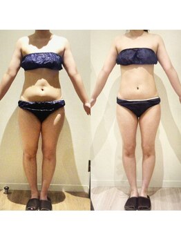 アユアランリンク 札幌店/20代前半/2ヵ月-6kg